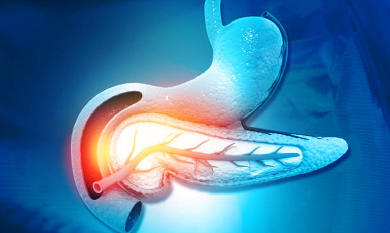 Pankreas İltihabı