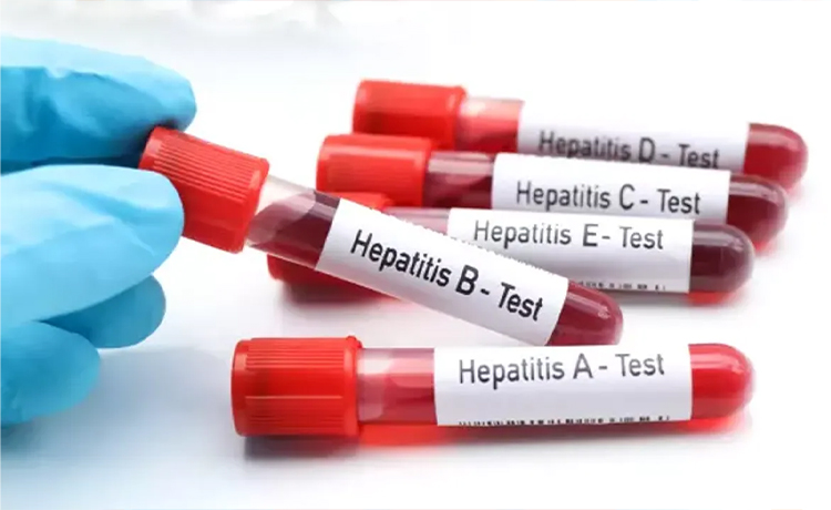 Hepatit Türleri Nelerdir?