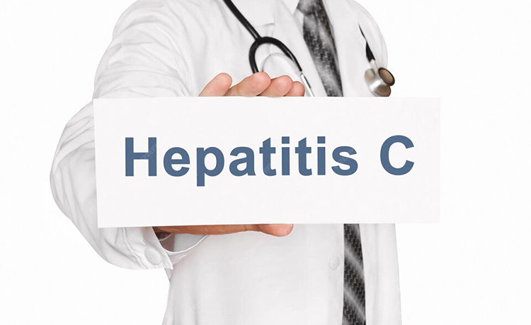 Hepatit C
