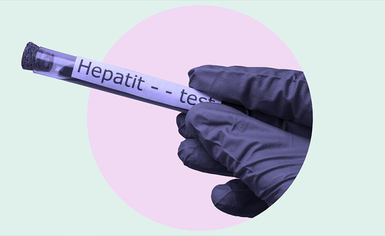 Hepatit Hastalığı